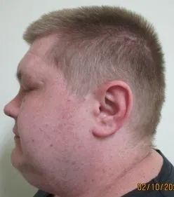 Mann mit kurzgeschorenen, blonden Haaren, der im Profil zu sehen ist. Er wird von der Polizei gesucht, da er nach einem Freigang nicht in eine Klinik zurückgekehrt ist.