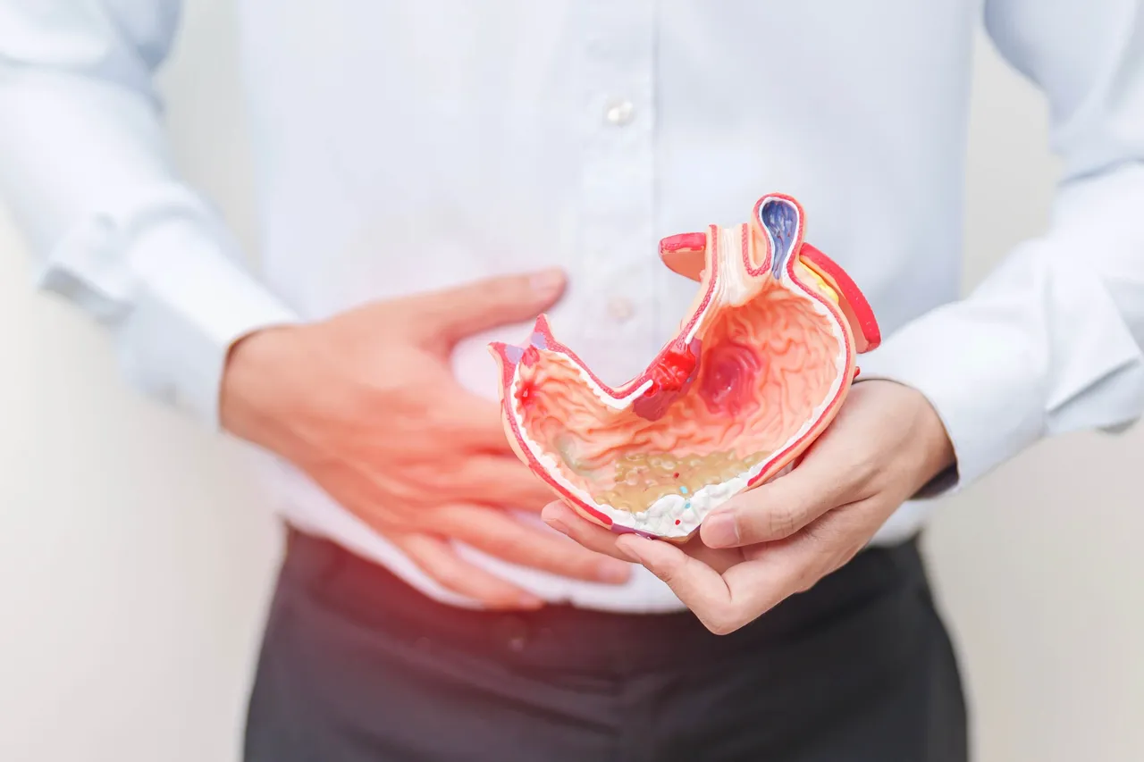 Eine Person hält ein anatomisches Modell eines Magens und hält sich mit der anderen Hand den Bauch.
